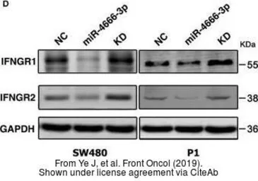Anti-Interferon gamma Receptor 2 antibody, C-term used in Western Blot (WB). GTX81601