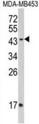 Anti-Interferon gamma Receptor 2 antibody, C-term used in Western Blot (WB). GTX81601