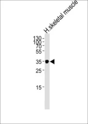 Anti-Interferon gamma Receptor 2 antibody, C-term used in Western Blot (WB). GTX81601