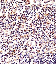 Anti-LAG3 antibody, Internal used in IHC (Paraffin sections) (IHC-P). GTX81605