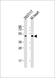 Anti-LAG3 antibody, Internal used in Western Blot (WB). GTX81605