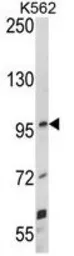 Anti-UNC5C antibody, Internal used in Western Blot (WB). GTX81651