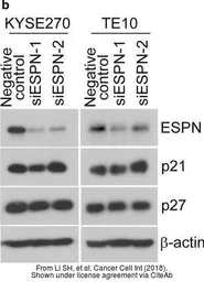 Anti-ESPN antibody, N-term used in Western Blot (WB). GTX81675