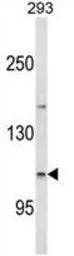Anti-ESPN antibody, N-term used in Western Blot (WB). GTX81675