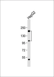 Anti-CORIN antibody, Internal used in Western Blot (WB). GTX81681