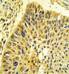 Anti-Calponin 1 antibody, N-term used in IHC (Paraffin sections) (IHC-P). GTX81714