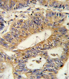 Anti-IL17 Receptor beta antibody, Internal used in IHC (Paraffin sections) (IHC-P). GTX81729