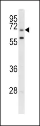 Anti-GARP antibody, Internal used in Western Blot (WB). GTX81794