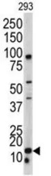 BAALC antibody, N-term