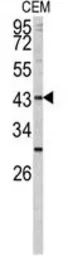 Anti-FUT1 antibody, Internal used in Western Blot (WB). GTX81834