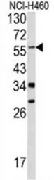 Anti-YAP1 antibody, C-term used in Western Blot (WB). GTX81839