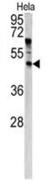 Anti-ANGPTL7 antibody, N-term used in Western Blot (WB). GTX81863