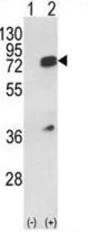 Anti-hnRNP L antibody, Internal used in Western Blot (WB). GTX81941