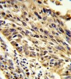 Anti-TRIP13 antibody, N-term used in IHC (Paraffin sections) (IHC-P). GTX81984
