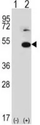 Anti-TRIP13 antibody, N-term used in Western Blot (WB). GTX81984