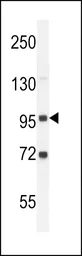 Anti-GPLD1 antibody, C-term used in Western Blot (WB). GTX82504