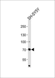 Anti-ZFP219 antibody, N-term used in Western Blot (WB). GTX82519