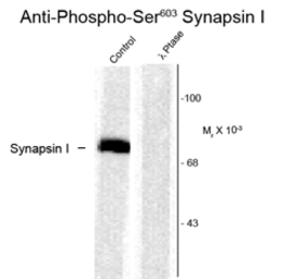 Anti-Synapsin I (phospho Ser603) antibody used in Western Blot (WB). GTX82589