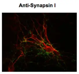 Anti-Synapsin I antibody used in Immunocytochemistry/ Immunofluorescence (ICC/IF). GTX82594