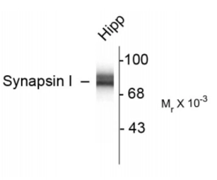 Anti-Synapsin I antibody used in Western Blot (WB). GTX82594