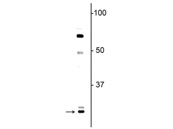 Anti-OLIG1 antibody used in Western Blot (WB). GTX82621