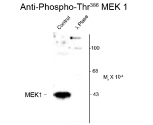 Anti-MEK1 (phospho Thr386) antibody used in Western Blot (WB). GTX82656