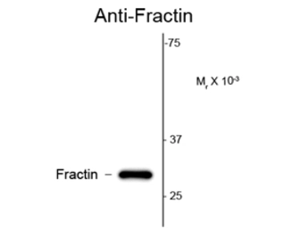 Anti-Fractin antibody used in Western Blot (WB). GTX82694