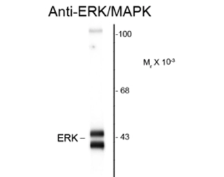 Anti-ERK1/2 antibody used in Western Blot (WB). GTX82697