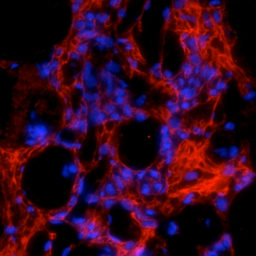 Anti-COL1A1 antibody used in IHC (Paraffin sections) (IHC-P). GTX82720