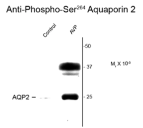 Anti-Aquaporin 2 (phospho Ser264) antibody used in Western Blot (WB). GTX82735