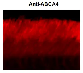 Anti-ABCA4 (Rim Protein) antibody [3F4] used in Immunohistochemistry (IHC). GTX82741
