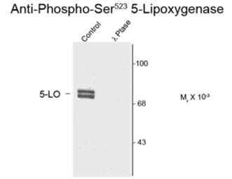 Anti-5-Lipoxygenase (phospho Ser523) antibody used in Western Blot (WB). GTX82744