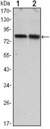 Anti-TORC2 antibody [5B10] used in Western Blot (WB). GTX82754