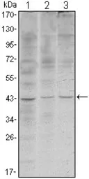 Anti-WIF1 antibody [1G5] used in Western Blot (WB). GTX82765