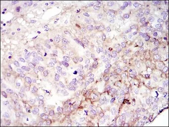 Anti-FAK antibody [10H7] used in IHC (Paraffin sections) (IHC-P). GTX82780