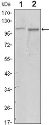 Anti-FAK antibody [10H7] used in Western Blot (WB). GTX82780