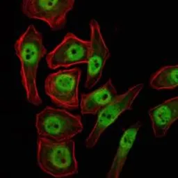 Anti-KDM4A antibody [5H1] used in Immunocytochemistry/ Immunofluorescence (ICC/IF). GTX82792