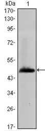 Anti-HAS1 antibody [3E10] used in Western Blot (WB). GTX82799