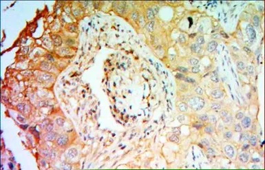 Anti-CCK4 antibody [4F9] used in IHC (Paraffin sections) (IHC-P). GTX82801