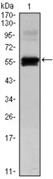 Anti-PAX6 antibody [1C8] used in Western Blot (WB). GTX82816