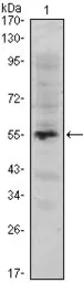 Anti-EXPAND1 / MUM1 antibody [4G10] used in Western Blot (WB). GTX82832