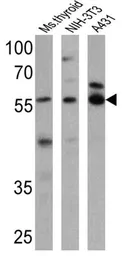 Anti-Thyroid Hormone Receptor alpha-2 antibody used in Western Blot (WB). GTX82858