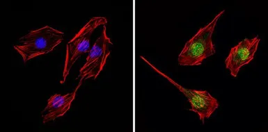 Anti-Thyroid Hormone Receptor alpha-2 antibody used in Immunocytochemistry/ Immunofluorescence (ICC/IF). GTX82858