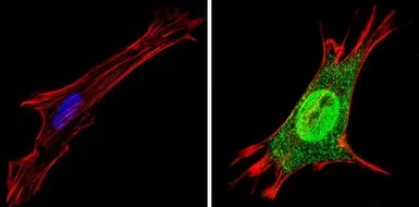 Anti-Thyroid Hormone Receptor alpha-2 antibody used in Immunocytochemistry/ Immunofluorescence (ICC/IF). GTX82858