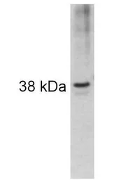Anti-ARA9 antibody used in Western Blot (WB). GTX82866
