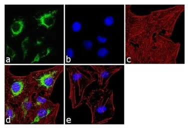 Anti-IP3 Receptor II antibody used in Immunocytochemistry/ Immunofluorescence (ICC/IF). GTX82888