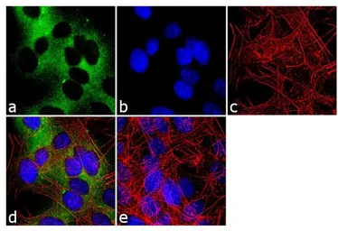 Anti-nNOS antibody used in Immunocytochemistry/ Immunofluorescence (ICC/IF). GTX82905
