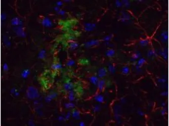 Anti-beta Amyloid antibody used in IHC (Frozen sections) (IHC-Fr). GTX82974
