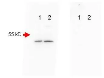 Anti-beta Amyloid antibody used in Western Blot (WB). GTX82974
