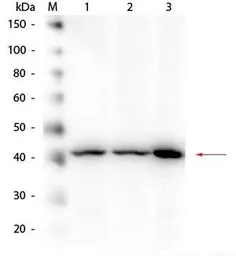 Anti-beta Amyloid antibody used in Western Blot (WB). GTX82974